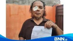 Wartawan di Takalar Diduga Dianiaya dan Diancam Dibunuh Usai Beritakan Kasus KDRT